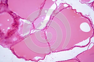 Thyroid gland under a microscope, light micrograph exhibiting typical follicular structure and colloid-filled follicles