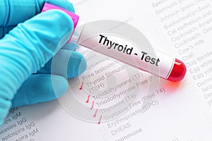 Thyroid panel test