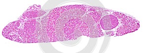 Thyroid and parathyroid gland