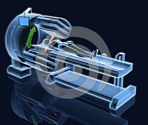 Thyroid scan of scintigraphy, medically 3D illustration