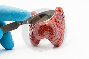Thyroid surgery. Surgeon holding in gloved hand surgical scalpel over of volume model of thyroid gland. Concept for surgery operat