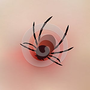 Tick bite on human scin. Realistic vector illustration