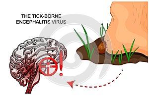 The tick-borne encephalitis virus. tick