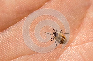 Tick filled with blood crawling on human body skin