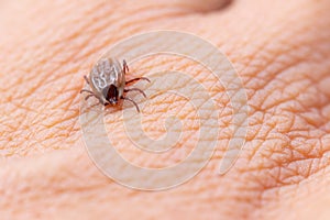 Tick filled with blood on human skin