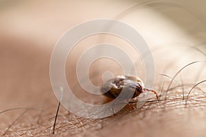 Tick filled with blood on human skin