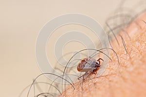 Tick filled with blood on human skin