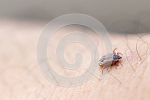 Tick filled with blood on human skin