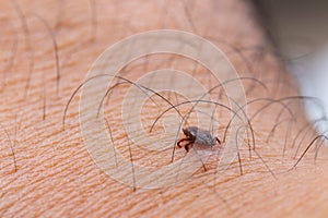 Tick filled with blood on human skin