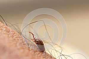 Tick filled with blood on human skin