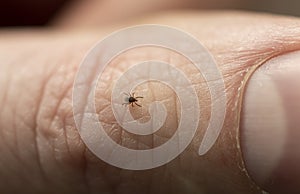 Small tick on human finger, danger in forest