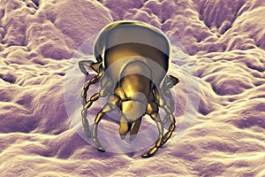 Tick Ixodes, an arthropod responsible for transmission of bacterium Borrelia burgdorferi