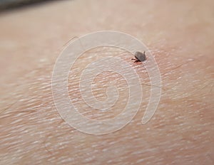 Tick Ixodes ricinus on human skin. tick wandering over human hand.