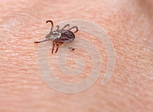 Tick on Skin