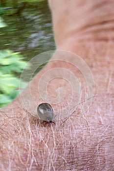 Tick on a skin. Ectoparasite, castor.