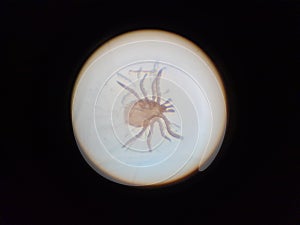 Tick under microscope