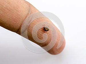 Ticks on Man photo