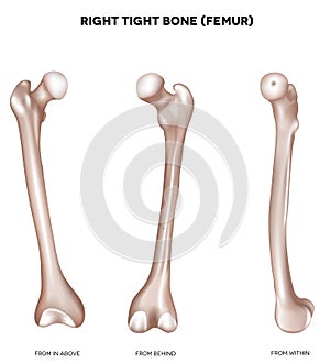 Tight bone- Femur photo