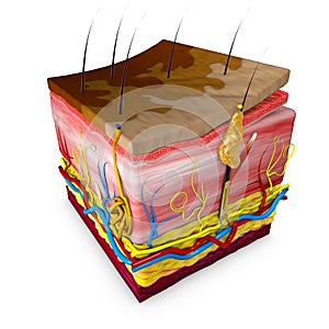 Tinea versicolor is a condition characterized by a skin eruption