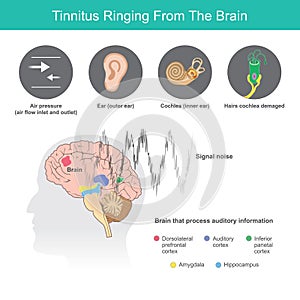 Tinnitus Ringing From The Brain, Is the term for a buzzing noise in your ears from symptoms abnormal in ears