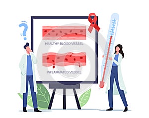 Tiny Doctors with Huge Thermometer Stand at White Board with Infographics Healthy and Inflammated Vessels, Rosacea