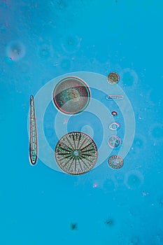 tiny microscopic diatoms