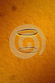 tiny microscopic diatoms