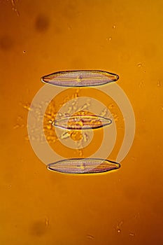 tiny microscopic diatoms