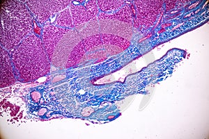 Tissue of Liver under the microscope for education.