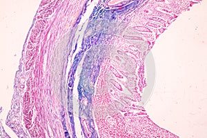 Small intestine Duodenum and Vermiform appendix  Human under the microscope.