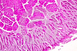 Small intestine Duodenum and Vermiform appendix  Human under the microscope.