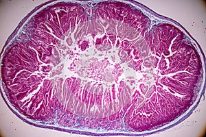 Tissue of small intestine or small bowel under the microscopic.