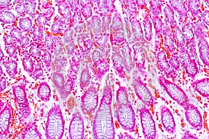 Tissue of Stomach under the microscope for education.