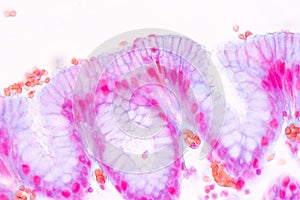 Tissue of Stomach under the microscope for education.