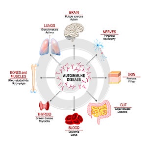 Tissues of the human body affected by autoimmune attack