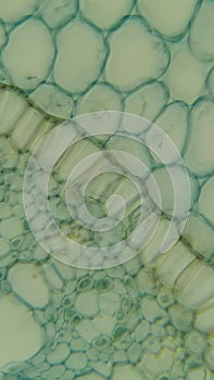 Tissues of primary structure of iris root photo