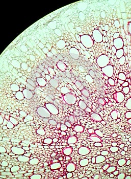 Tissues of secondary root structure, microscopic photography