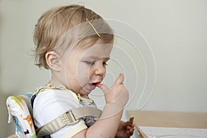 Toddler with hand , foot and mouth disease