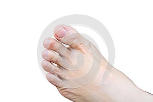 Toe