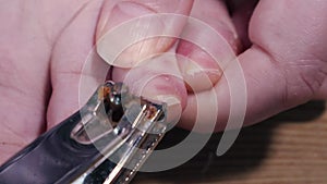 Toe nails being clipped on a foot