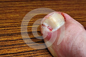 Toenail