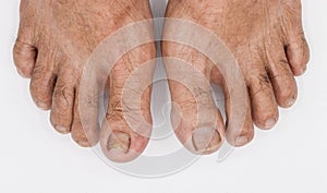 Toes of Asian elder man. Concept of aging photo