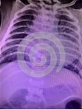 TOF x-ray