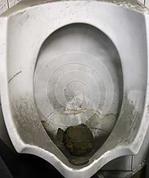 Toilet dirty unhygienic