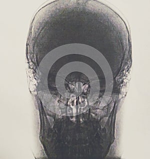 tomography of human head.. no pathologies photo