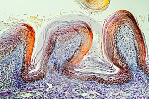 Tongue Tissue with taste buds across photo
