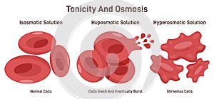 Tonicity as osmosis of the blood cells. Hypertonic, isotonic, hypotonic pressure