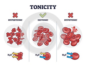 Tonicity as osmotic hypertonic, isotonic, hypotonic pressure outline diagram