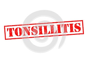 TONSILLITIS