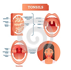Tonsils vector illustration. Tonsillitis labeled structure diagram. photo